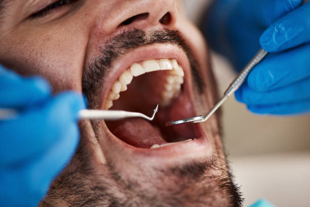 Best Walk-In Emergency Dentist in North Myrtle Beach, SC